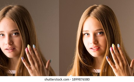 Before-after Processing. Woman Before And After Retouch. Comparison Of Portraits Before And After Skin Treatment. Two-frequency Decomposition In Photoshop. Retouching A Portrait In Photoshop