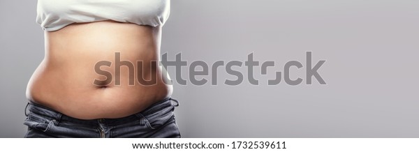 Belly Fat\
And Weight Lose. Overweight Woman\
Stomach
