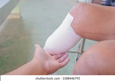 below knee amputation with elastic bandage