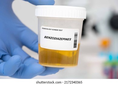 Benzodiazepines. Benzodiazepines Urinalysis. Urine sample in a container for analysis of the content of drugs, drugs, trace elements and hormones