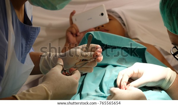 Berkhatan Means Circumcision Muslim Malay Community Stock Photo Edit Now 765565654