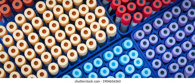 BERLIN, GERMANY - June 06, 2016: BD Vacutainer blood collection tubes