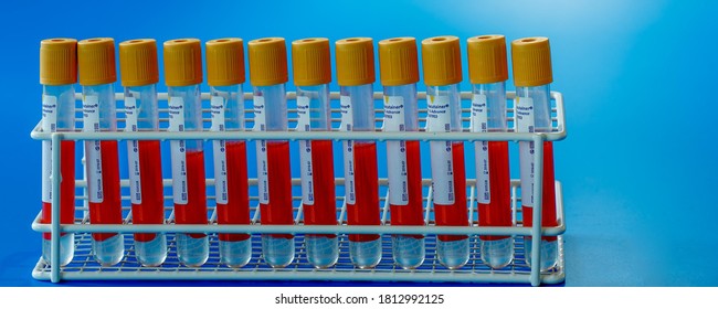 Berlin, Germany - May 15, 2014 : BD Vacutainer tubes, vacuum tubes for collecting blood samples in the lab
