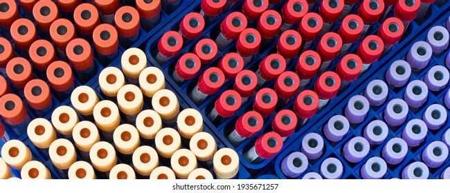 Berlin, Germany - May 15, 2014 : BD Vacutainer tubes, vacuum tubes for collecting blood samples in the lab