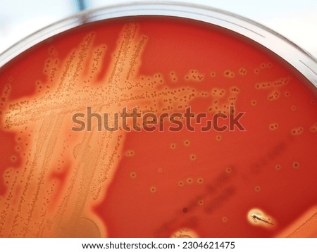 Beta hemolysis colonies of Streptococcus pyogenase on sheep blood agar plate.