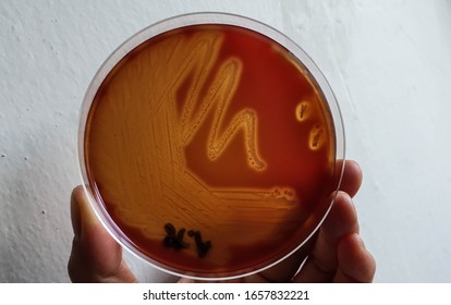 Beta Hemolysis Pattern Of Streptococcus Pyogenes On Blood Agar Plate