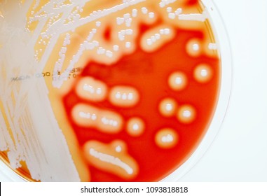 Beta Hemolysis Of Staphylococcus Aureus On Sheep Blood Agar, Blurry And Soft Focus 