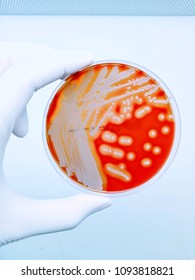 Beta Hemolysis Of Staphylococcus Aureus On Sheep Blood Agar, Blurry And Soft Focus 