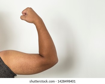 Biceps in people with skin diseases
