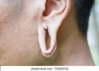 big-holes-earlobes-tribal-scars-260nw-73