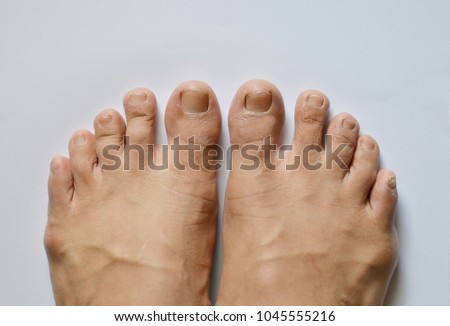 Big man's toes