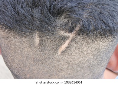 Big scars on the head Scars from sharp.