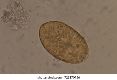 Liver Fluke Images, Stock Photos & Vectors | Shutterstock