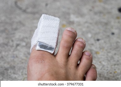 Big Toe Foot After Accident