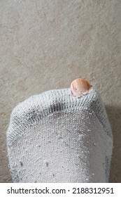 Big Toe, The Hallux, Poking Out Of Hole In White Sock. Top-down View On Beige Ceramic Tile Floor. Selective Focus