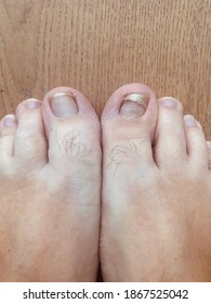 toenails growing up