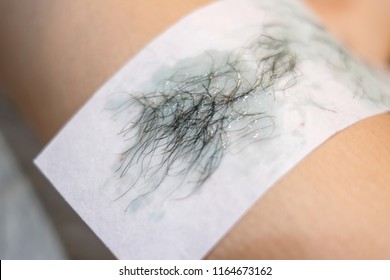 Bikini Wax Images Stock Photos Vectors Shutterstock