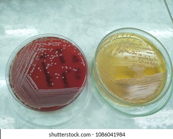 Biochem Acinetobacter Baummannii