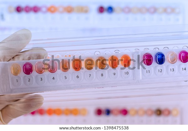 Biochemical Test Kit Microorganism Identification Stock Photo ...