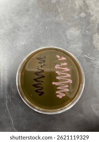 Biochemical Testing of Bacteria on EMB agar