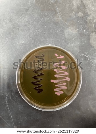 Biochemical Testing of Bacteria on EMB agar