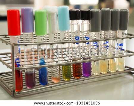 The biochemical testing of Salmonella in the rack.