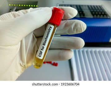 Biochemist Hold Cerebrospinal Fluid Csf Sample Stock Photo 1923606704 ...