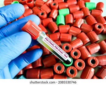 Biochemist hold test tubes with blood sample for PSA (Total and Free) test. Prostate specific antigen, diagnosis of prostate cancer