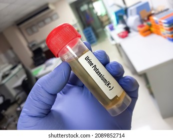 Biochemist holding urine sample for Urine Potassium Test. Electrolytes test