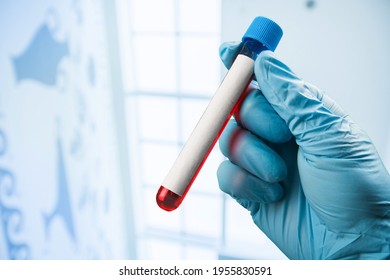 Biochemist Or Lab Technologist Hand Holds Blood Sample For Test.