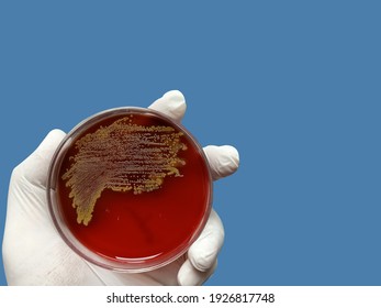 Biochemist of Lab Technologist holds Bacteria culture growth on Selective media plate in Microbiology Laboratory, Enterobacter cloacae. Bacteria culture growth on a petri dish.