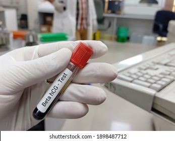 Biochemist or Lab Technologist holds Blood sample for a beta hCG hormone test. Pregnancy test.