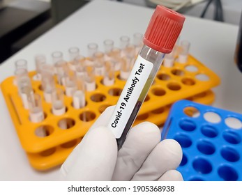 Biochemist or Lab Technologist holds Blood sample for Covid-19 antibody test in the laboratory. Biochemistry lab Close view. IgG, IgM test of Covid-19.