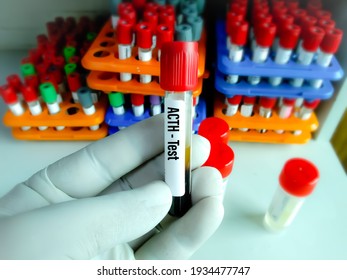 Biochemist or Lab Technologist holds Blood sample for Adrenocorticotropic hormone (ACTH) test, diagnosis of Addison's disease with laboratory background.