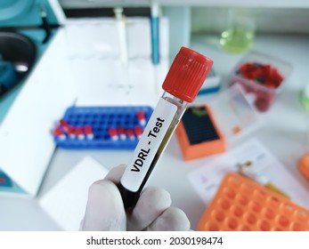 Biochemist Or Lab Technologist Holds Blood Sample For VDRL Test With Laboratory Background.