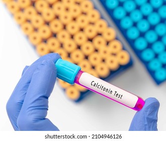 Biochemistry Blood Sample For Calcitonin Test