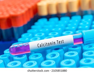 Biochemistry Blood Sample For Calcitonin Test