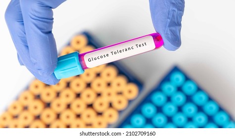 Biochemistry Blood Sample For Glucose Tolerance Test