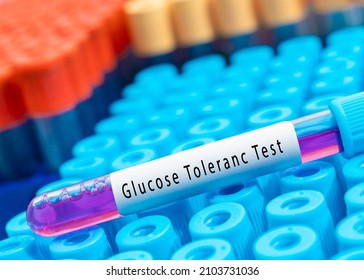 Biochemistry Blood Sample For Glucose Tolerance Test