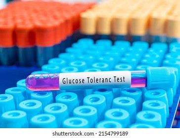 Biochemistry Blood Sample For Glucose Tolerance Test