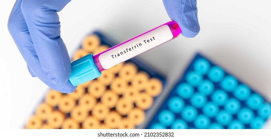 biochemistry-blood-sample-transferrin-test-stock-photo-2102352832