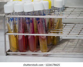 Biochemistry Test Bacteria Culture Laboratory Stock Photo 1226178625 ...