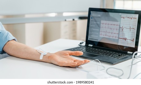 Biofeedback - female hand with attached sensors for heart rate measurement. Biofeedback is a complementary health improvement technique used in some health centers. 