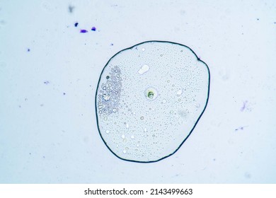 Biological Fluid Crime Scene Under Microscope Stock Photo 2143499663 ...