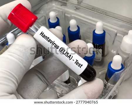 Biological Specimen blood test for detecting IgM and IgG antibodies (ELISA)  of Orthohantavirus or Hantavirus.