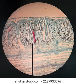 Biology Lab Equisetum Strobilus Cell