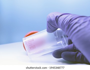 Biomaterial container in a doctors hand in medical glove. Sterile medical container for taking biomaterials. stool and urine analysis. Collecting analysis. Chronic prostatitis. Medical procedure 