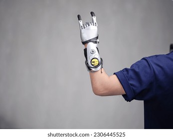 Bionic Hand Prosthesis Holding a Hand