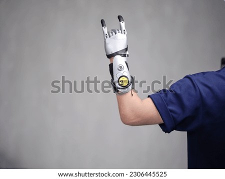 Bionic Hand Prosthesis Holding a Hand