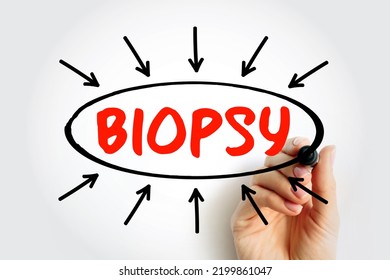 Biopsy - extraction of sample cells for examination to determine the presence or extent of a disease, text concept with arrows - Shutterstock ID 2199861047